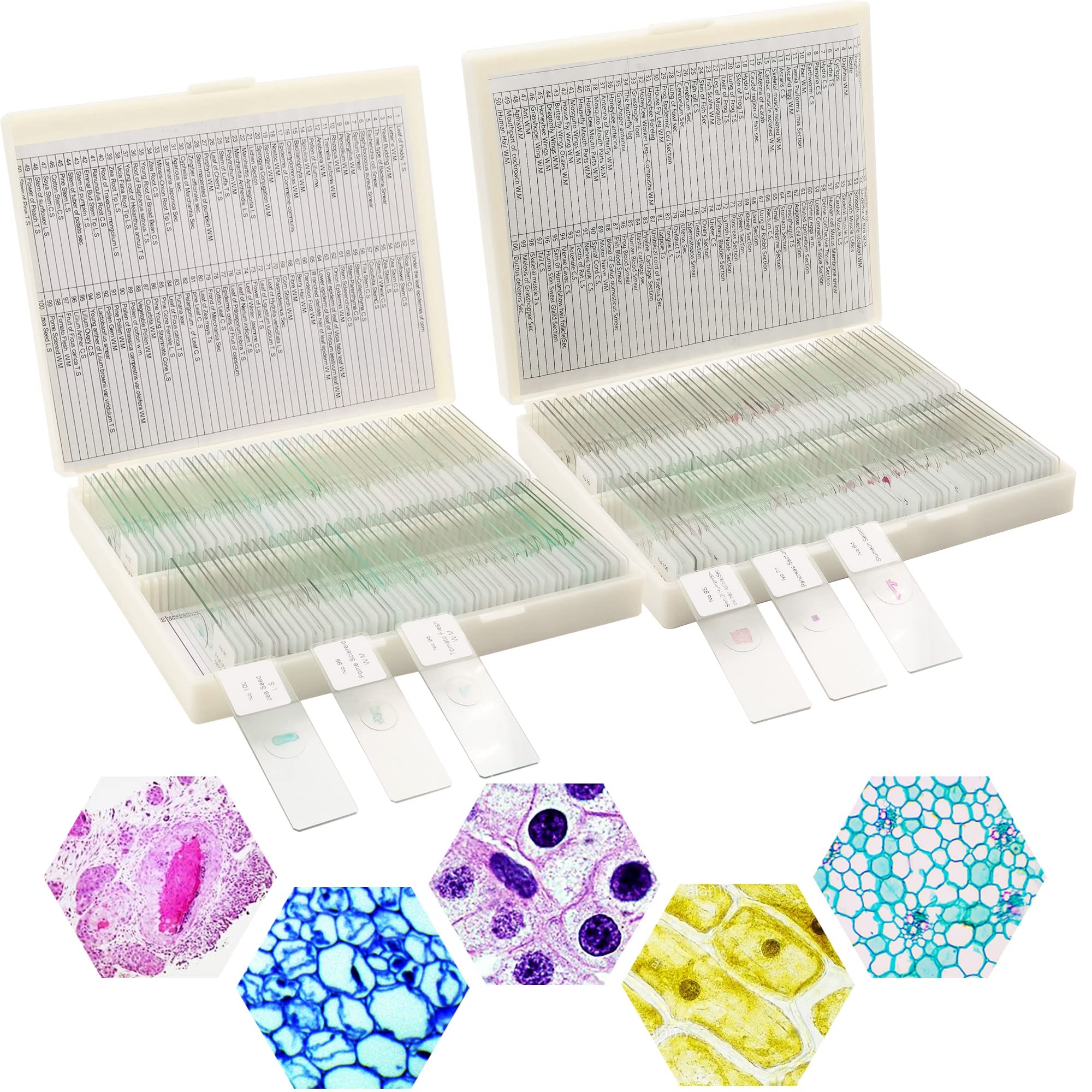 Prolee 200 Packs Microscope Slides 100 Plants U0026 100 Animal Tissues Includes Labels And Case For Biological Science Education Amazon Industrial U0026 Scientific